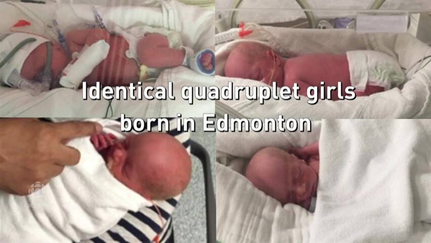 identical quadruplet babies