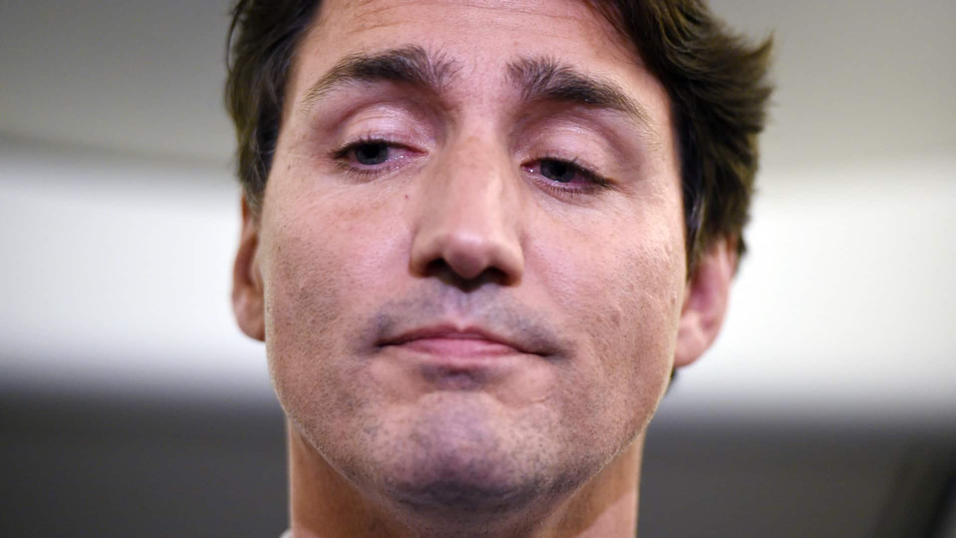 Will Blackface Scandal Bring Down Trudeau Sunday Scrum Cbcca 2332