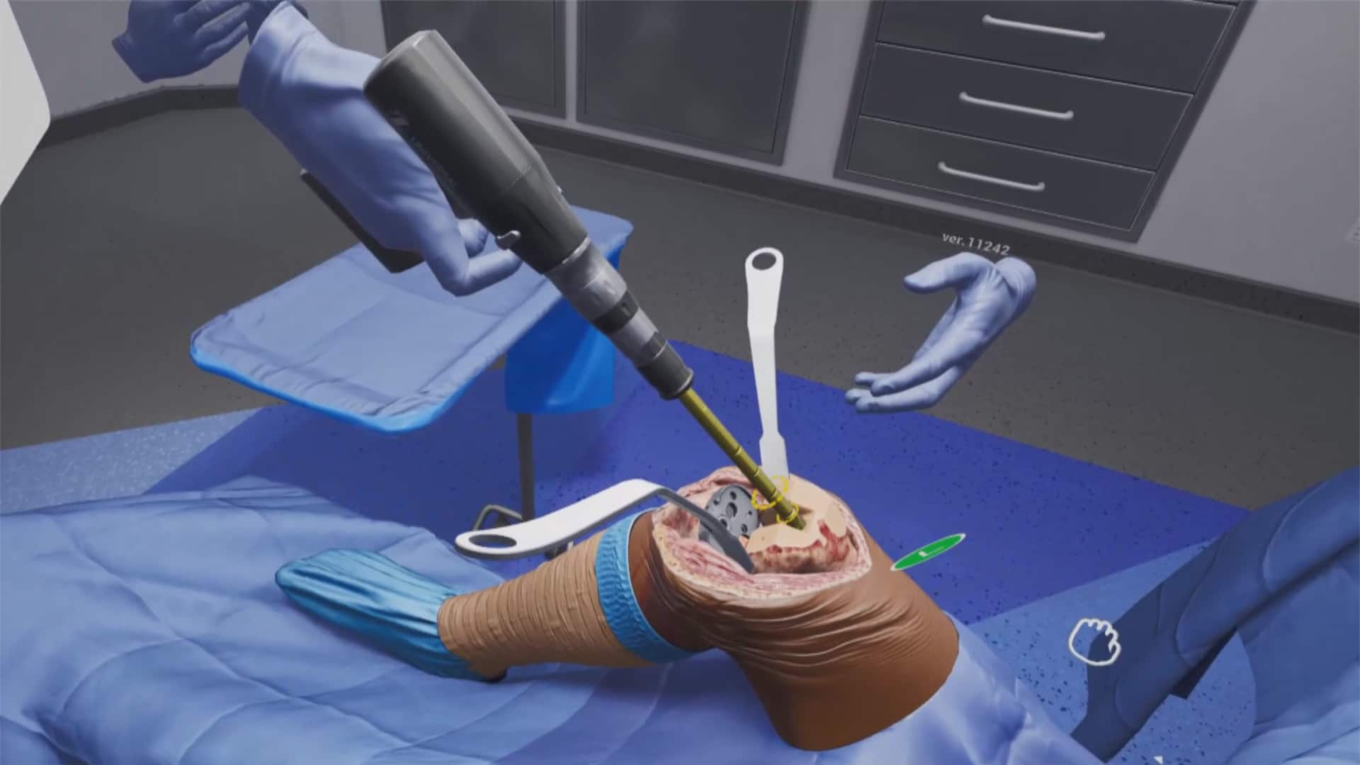 Practicing knee surgery in a virtual-reality simulation | CBC.ca